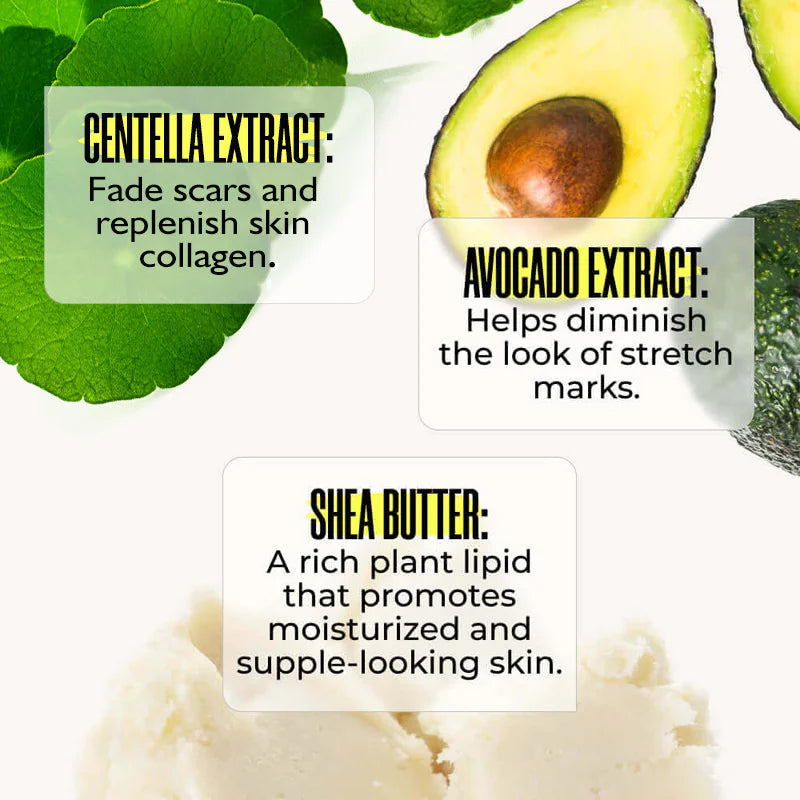 Stretch Erase Revitalizing Cream