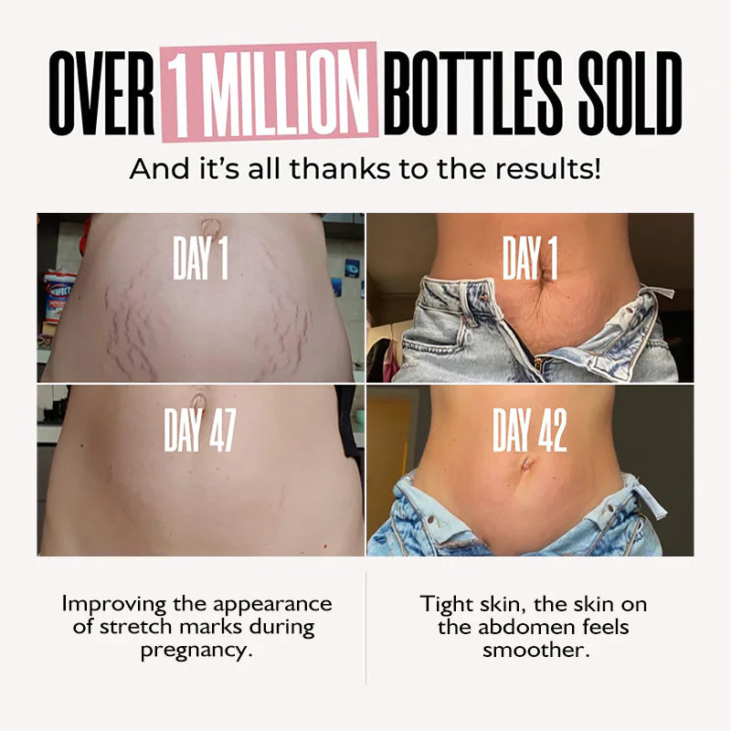 Stretch Erase Revitalizing Cream